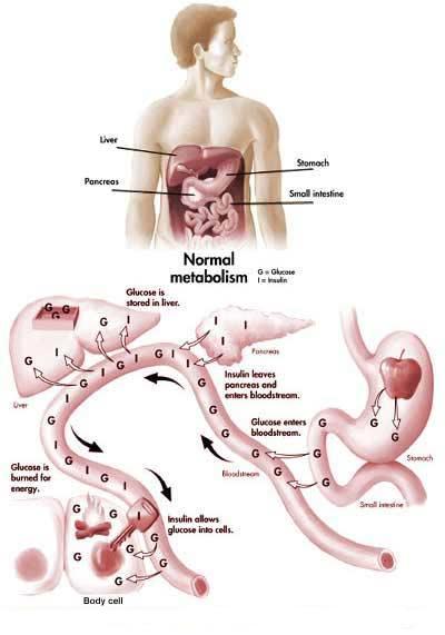 Hypoglycemia