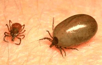 Lyme disease