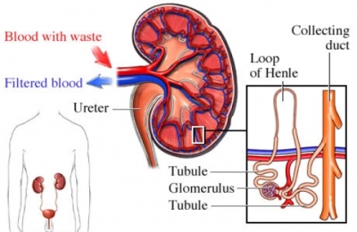 Nephrotic syndrome