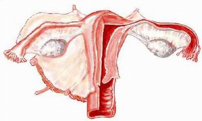 Ovarian cancer