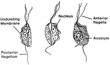 Trichomoniasis