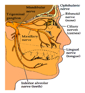 Trigeminal neuralgia